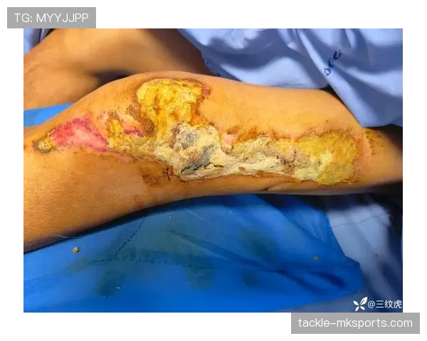 德布劳内成功接受大腿手术,恢复进展顺利且状态回暖 德布劳内成功接受大腿手术,恢复进展顺利且状态回暖